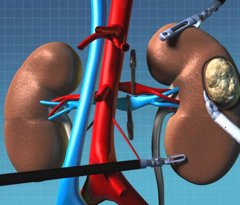 Urologist In Pathankot